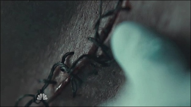 이젠홍콩인지욕망인지모르겠는미드 한니발(Hannibal) 시즌2 에피 4 Takiawase (3/3) (여러가지로주의) | 인스티즈